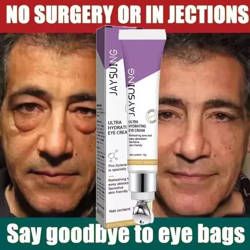 Cream for Instant Removal of Eye Bags Retinol Antiwrinkles Rassodante Leather Dissolvency Thin Lines Anti Dark Circle Gonfiore Illuminate Eye Care