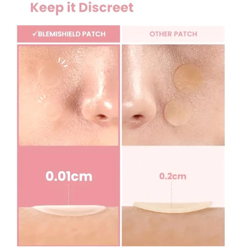 360 Pezzi di Cerotti per Acne e Brufoli a Forma di Cuore e Stella - Cura della Pelle Invisibile e Professionale
