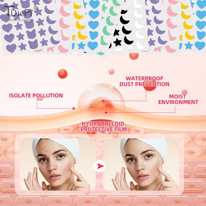 280 Pz/7 Foglio Invisibile Acne Patch Rimozione Brufolo Anti-Acne Idrocolloide Patch Macchie Mark Correttore Adesivo di Riparazione Impermeabile