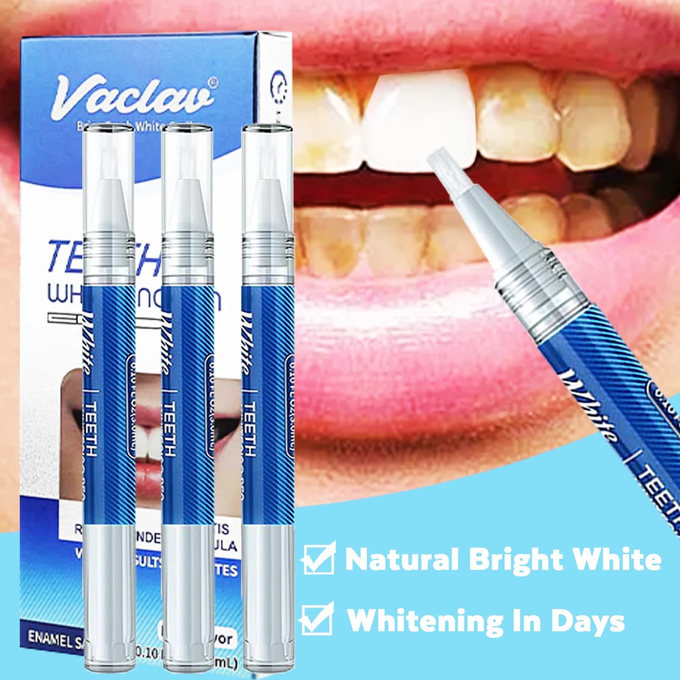 Whitening Pen for teeth Vaclav Whitening Gel for teeth whitening for teeth whitening for gel remove oral Hygene stains