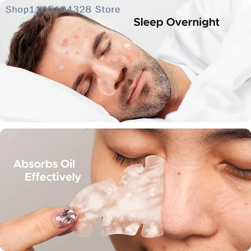 [HB] 364 Pz Removal Brufolo Invisibile Patch Anti-Acne Macchie Signs Corrector Tool Beauty Makeup Sticker Repair
