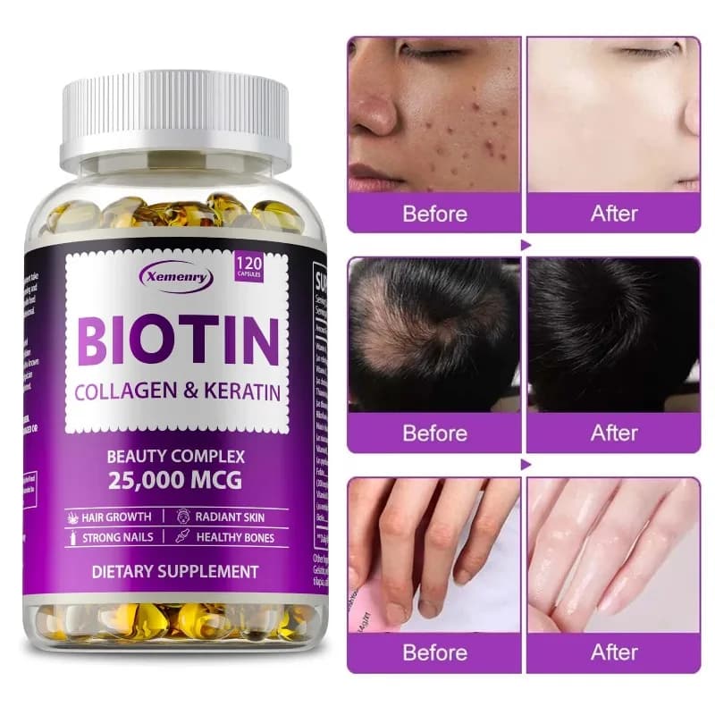 Integratore di biotina al collagene e cheratina - Supporta capelli sani, unghie forti e pelle radiosa - Crescita dei capelli per uomini e donne