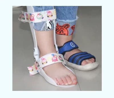 Bambini AFO Drop Foot Splint Baby caviglia piede Brace Night Splint Toddler Strephenopodia Strephexopodia Splint