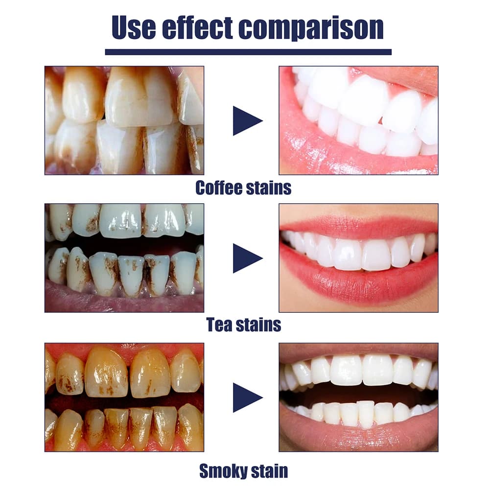 Niacinamide 100G whitening toothpaste with Natural care Fluoro-free for sensitive teeth - Brilliant smile