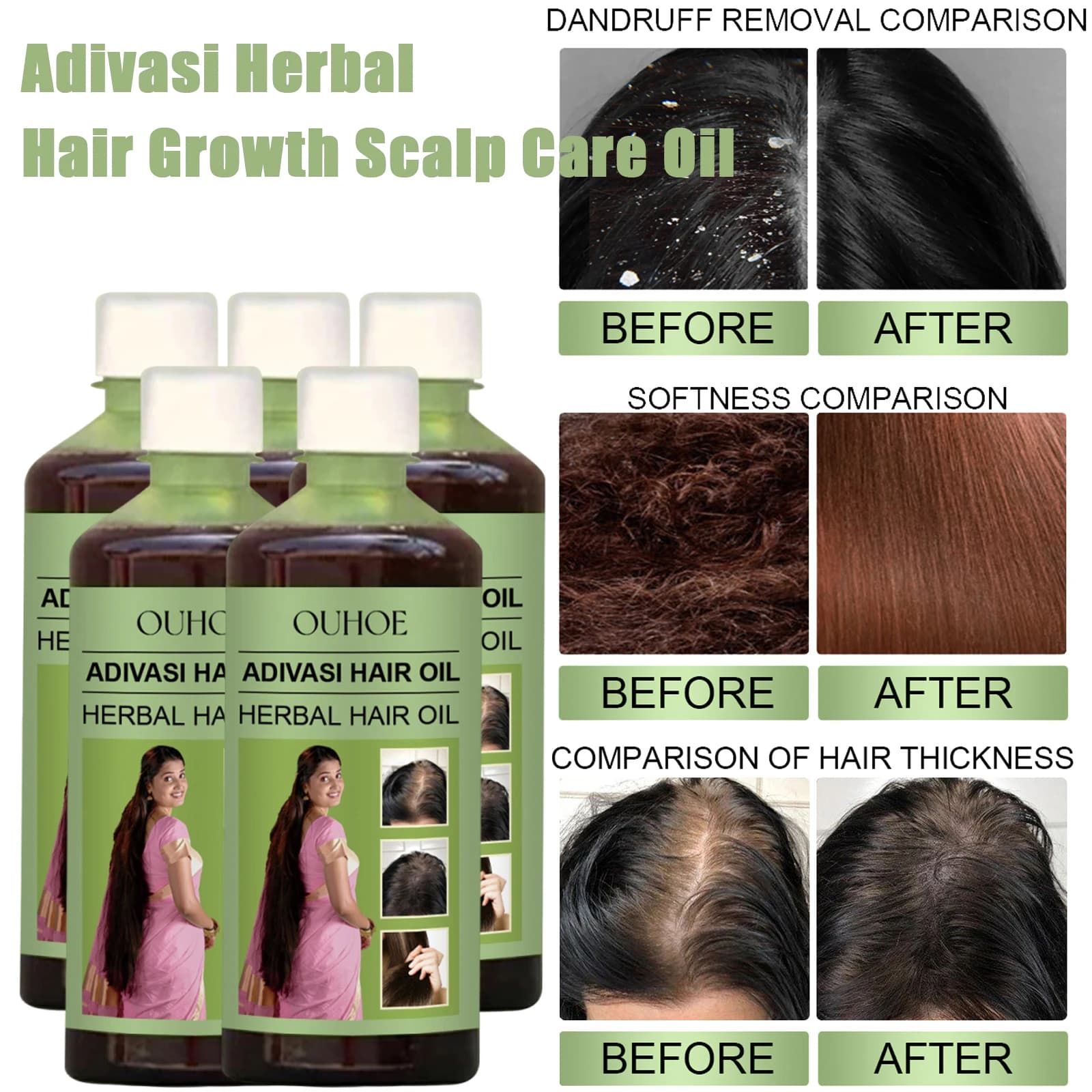 100ml Olio per la crescita dei capelli India Adivasi Cura dei capelli a base di erbe Riparazione del rosmarino Danneggiato Idratare Idratare il cuoio capelluto Ridurre la forfora