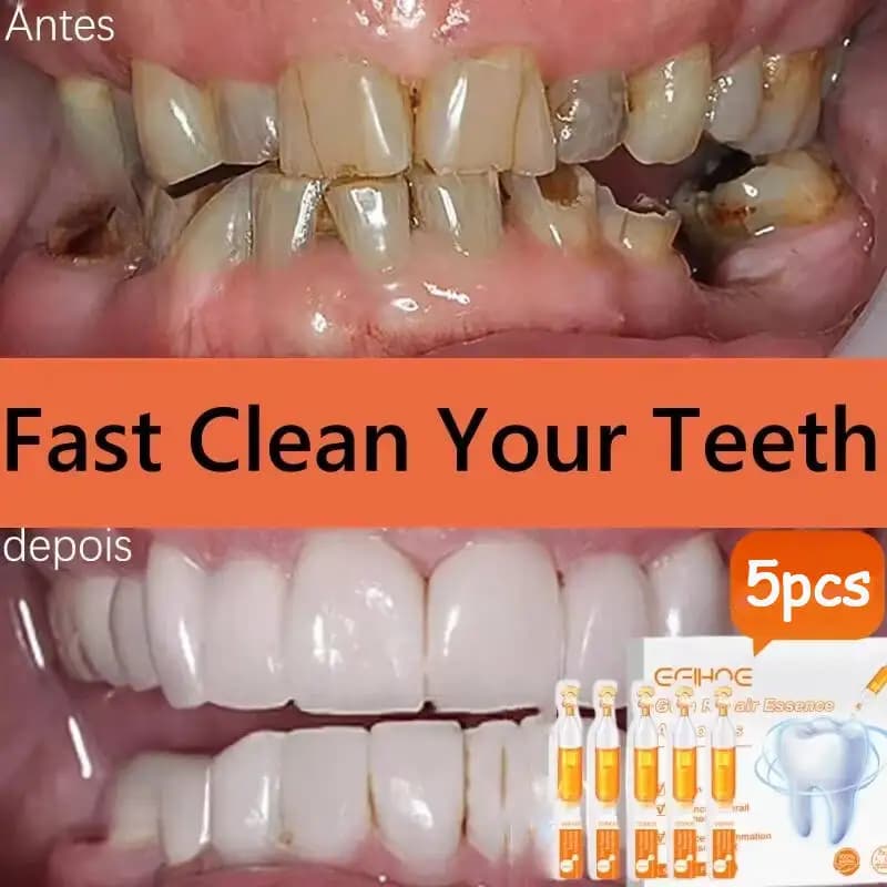 Quickly repair the serum of the gums Allevia the regrowth of the gums to the drops Whitening of the teeth Remove yellow plate stains Carie Mal of toothpaste