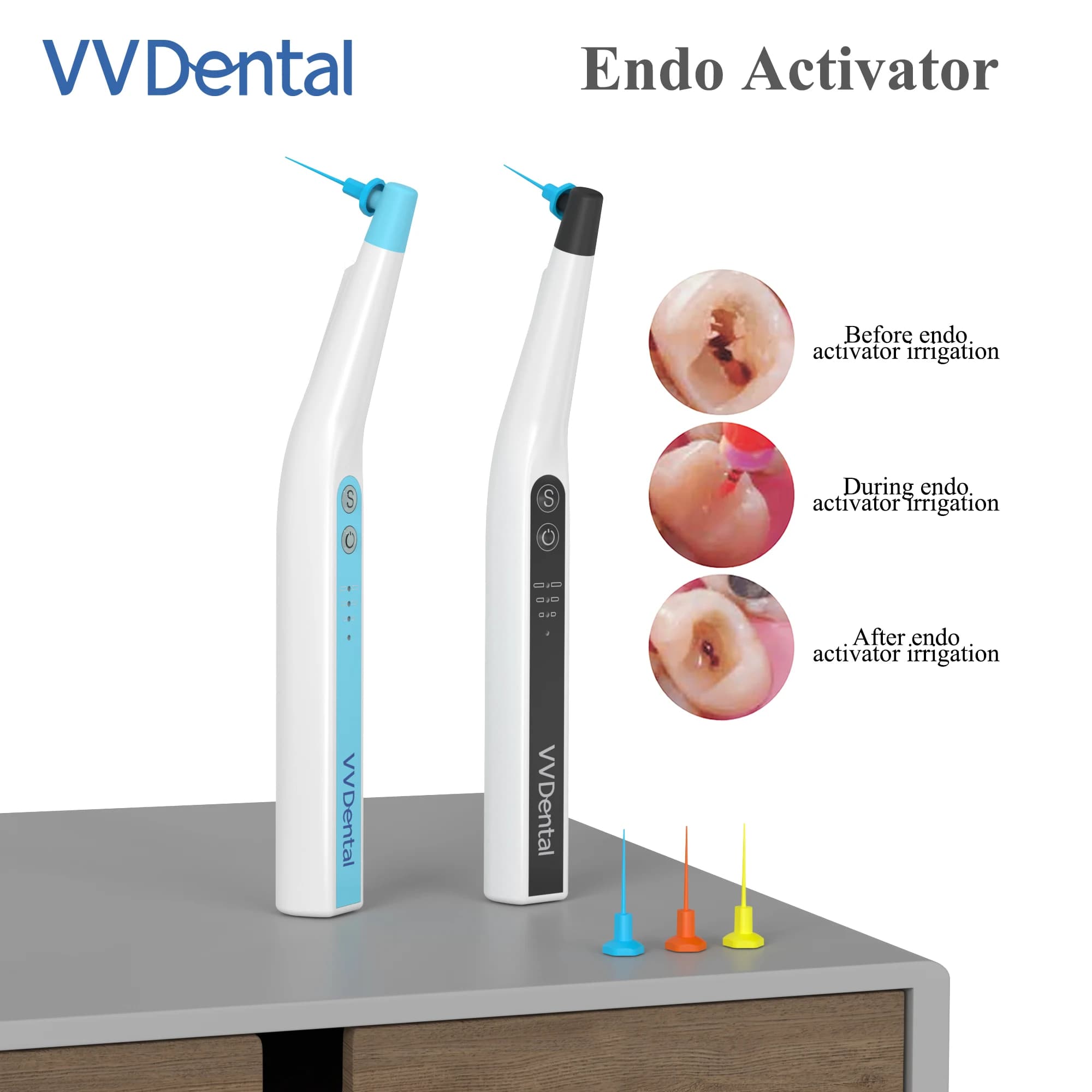 VV dental radicular channel sonic sprinkler with 60 endo file pieces for endodontic cleaning New dental tool Free shipping