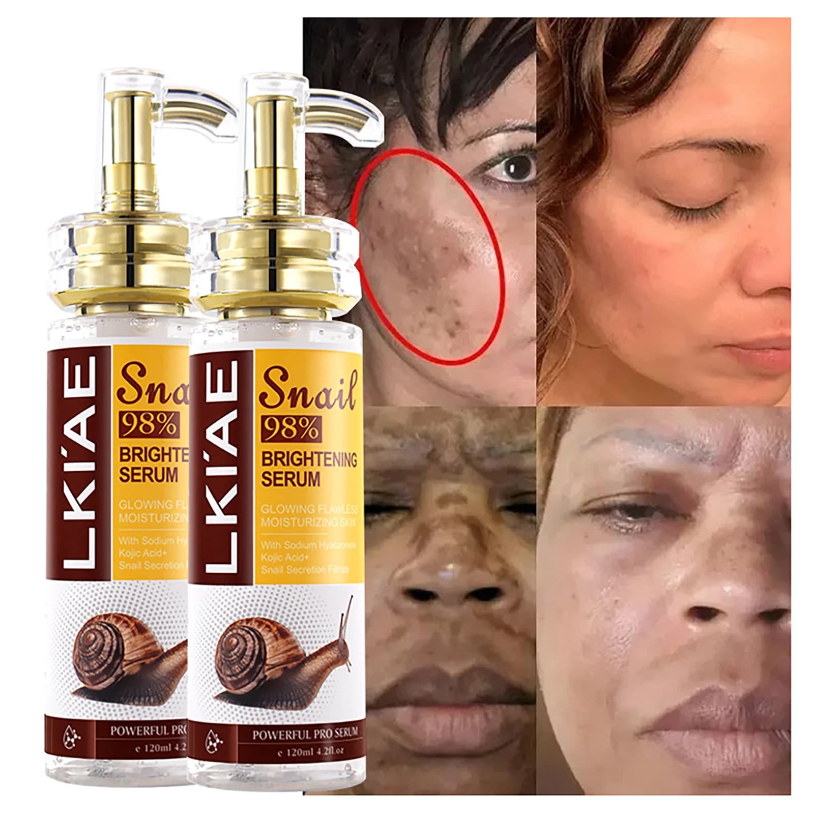 AILKE Siero sbiancante all'estratto di lumaca, idratante, riduce le macchie scure, le rughe, anche il tono della pelle, l'essenza schiarente per viso, il corpo