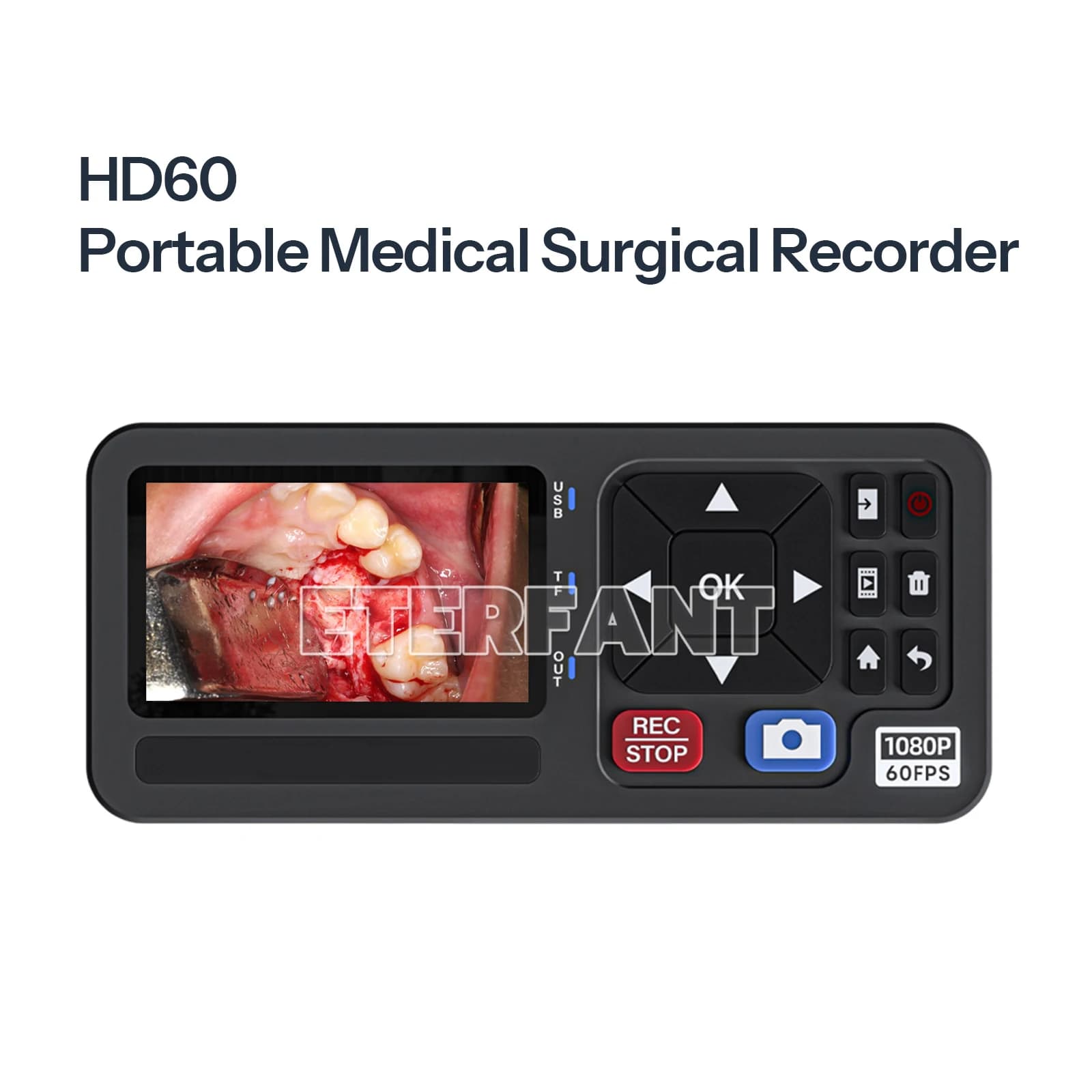 Registratore Chirurgico Portatile ETERFANT con Ingresso HDMI/VGA/YPbPr/CVBS per Laparoscopia ed Endoscopia, Acquisizione e Uscita 1080p60Hz