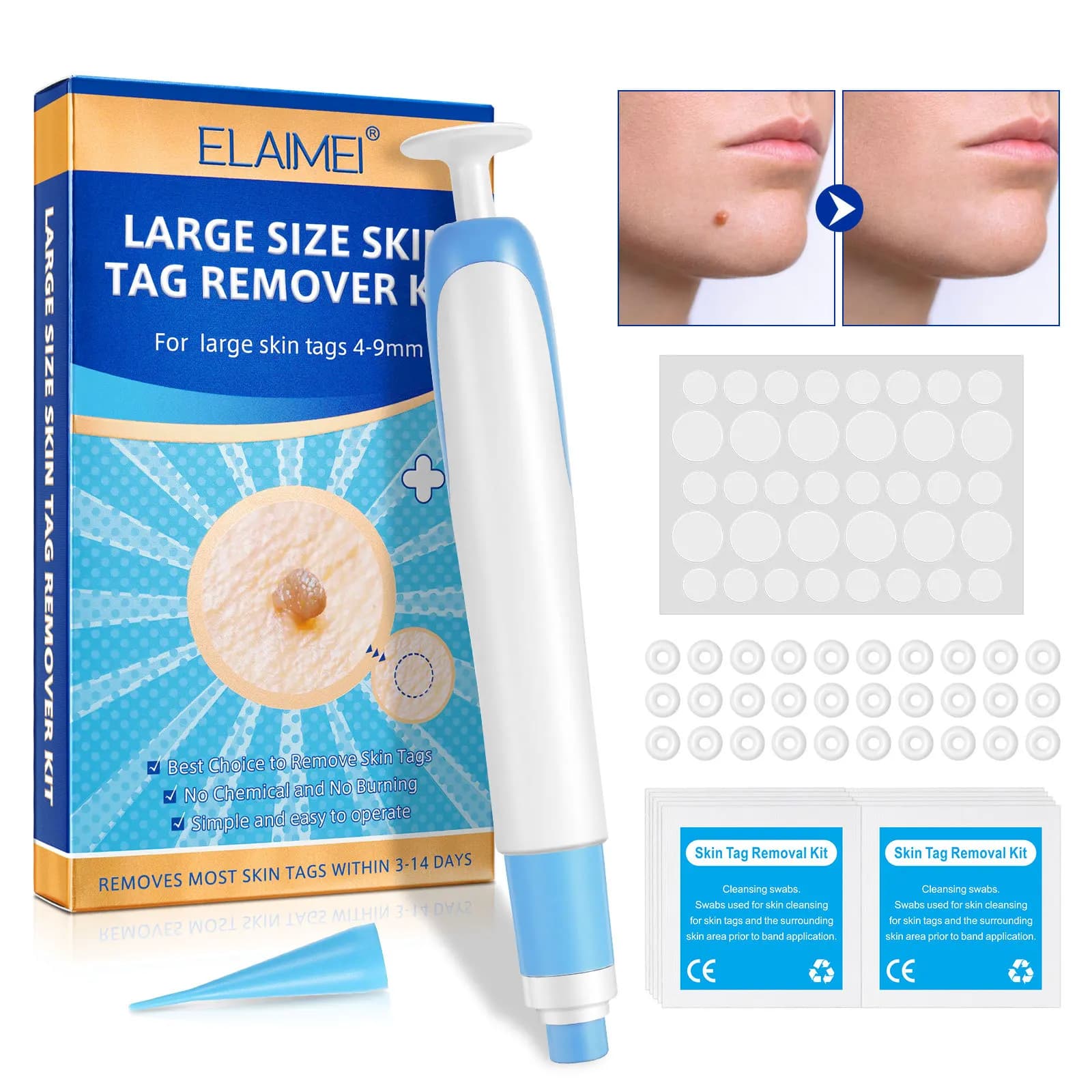 Kit per la rimozione automatica delle etichette della pelle di grandi dimensioni per etichette della pelle di grandi dimensioni 4-9mm con tamponi detergenti Strumento per la cura della pelle del viso per uso domestico