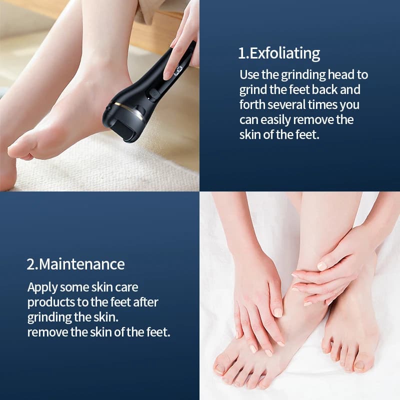 Smerigliatrice elettrica per piedi alimentata tramite USB, ricaricabile, con velocità regolabili, per la cura della pedicure degli uomini e delle donne