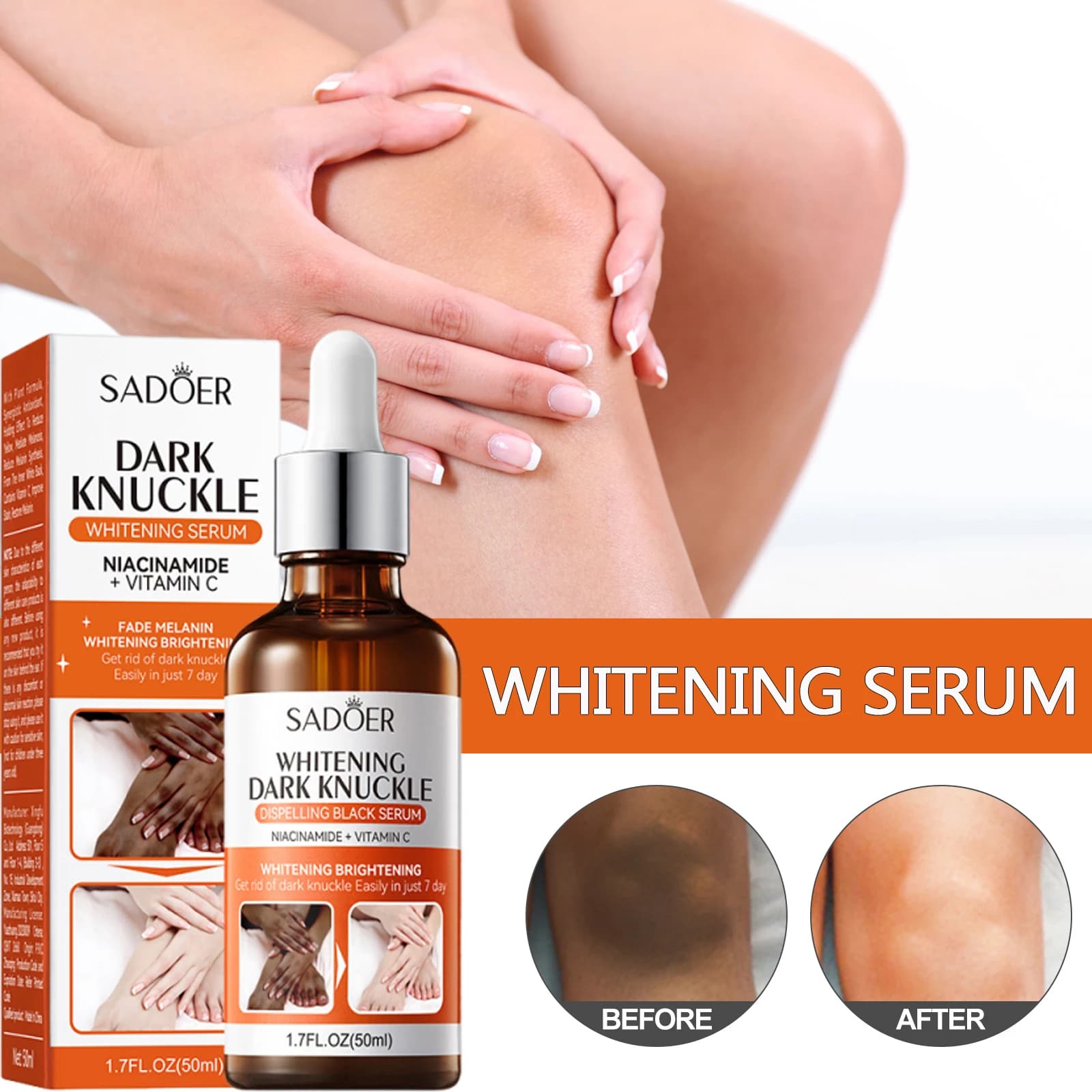 Quick Scratch Serum for Chestnuts, Elbows and Knees, Essence Remove Macchie for Dark Skin