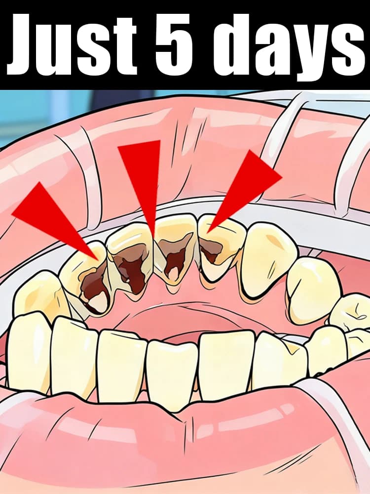 Lascia da un lado le tue preoccupazioni, apri la bocca in bocca aperta, mostra i denti, il profumo è fresco e fragrante.