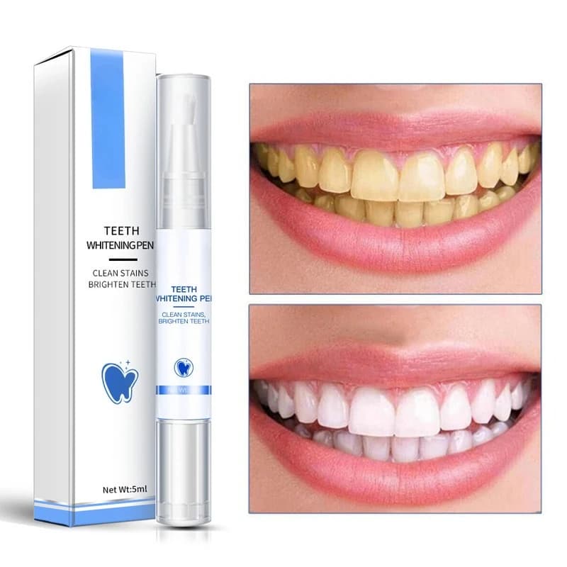 Siero per la pulizia della penna per sbiancamento dei denti Rimuovi macchie di placca Strumenti dentali Denti bianchi Spazzolino per penna per denti per l'igiene orale