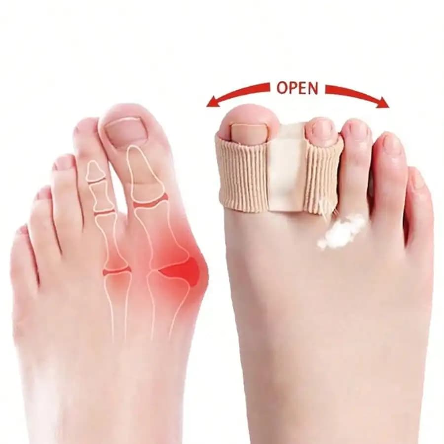 Sollievo dal dolore da bunion per stili di vita attivi – Confezione da 2 separatori per dita dei piedi, comodi per camminare, correre, fare escursioni e per l'uso quotidiano, supporto per scarpe resistente