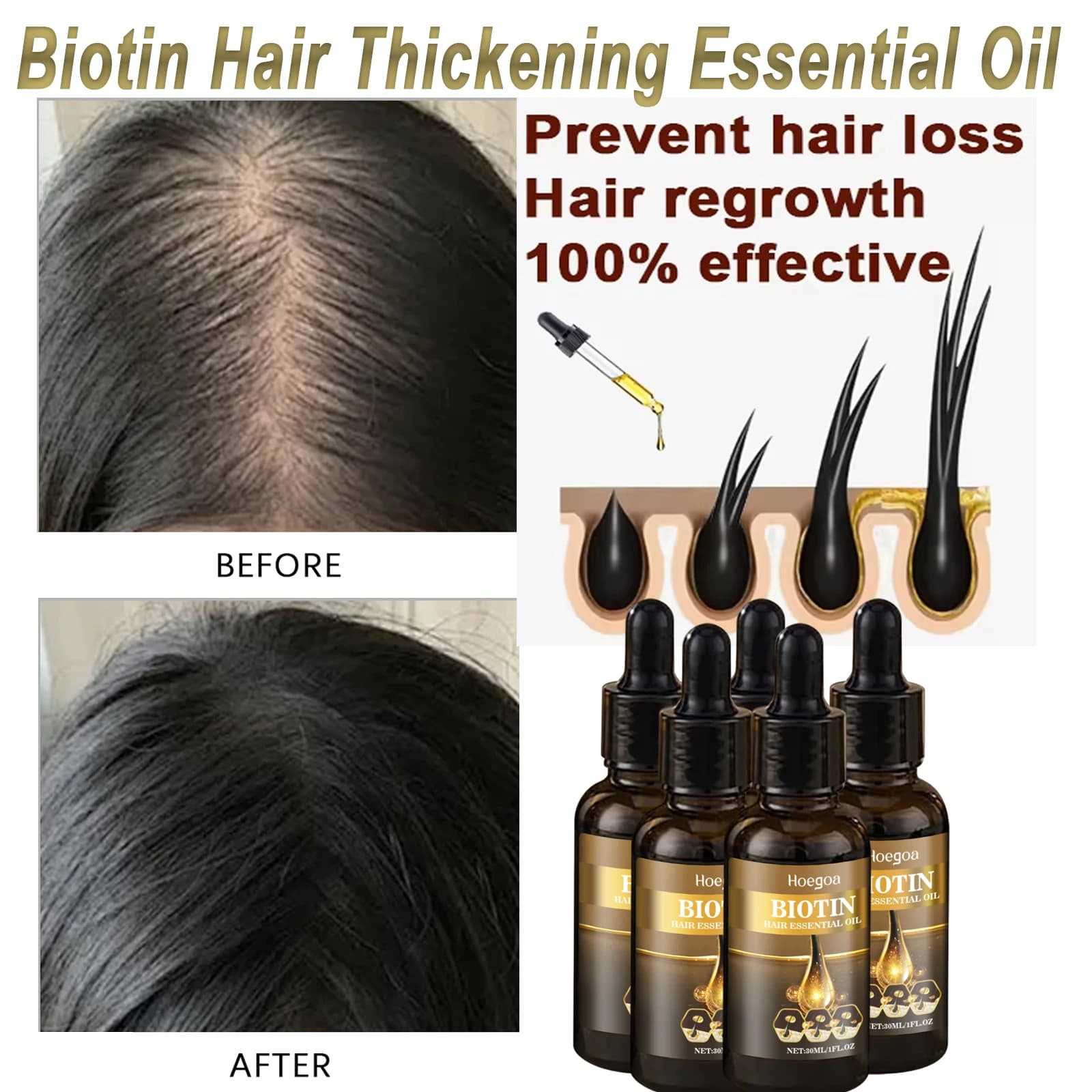 Repair the roots of damaged hair Serum of scalp Biotin Essence Improves androgenic alopecia Treatment of scalp Serum Strengthen hair roots
