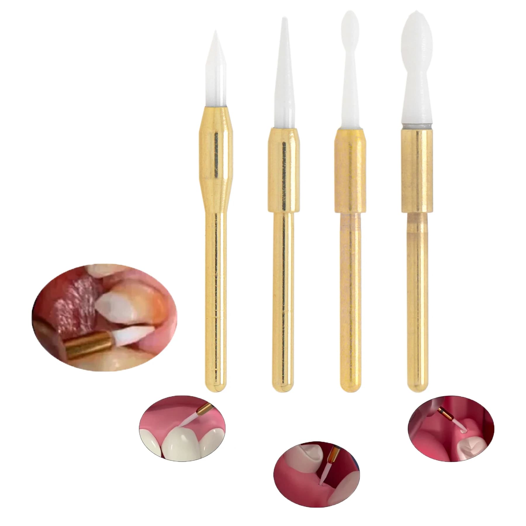 Dental trimmer Ceramic cutters for soft tissues Gingiva Trimmer Teeth whitening Instrument for plants Cleaning and whitening Product for dentists