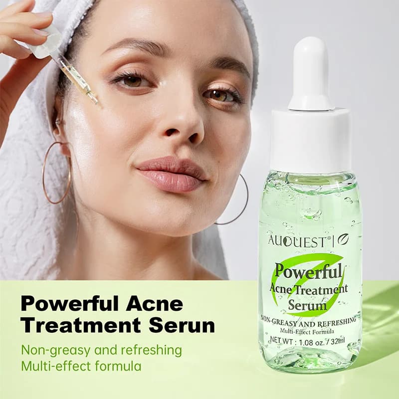 Il potente siero per il trattamento dell'acne controlla l'olio sbiadisce i segni dell'acne Cura delicatamente l'essenza del tono della pelle Dissolvenza Toppe scure Prodotti di bellezza