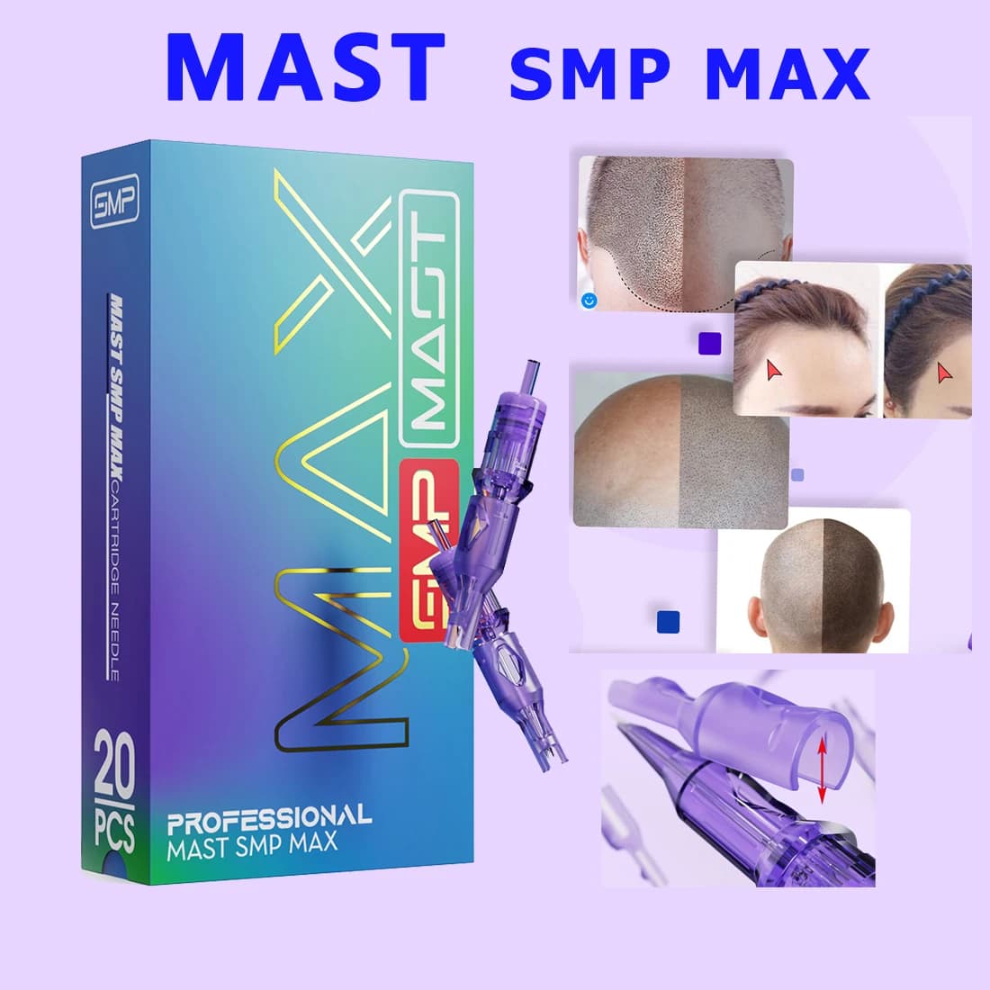 Cartucce per Aghi SMP Mast per Micropigmentazione del Cuoio Capelluto, 20 Pezzi, Aghi Professionali Monouso Compatibili con Penna Rotante