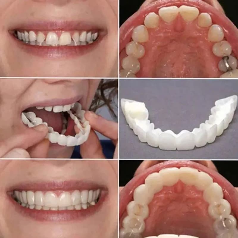 Nuove Faccette Dentali Sbiancanti Istantanee per un Sorriso, Riutilizzabili, Comode, Protesi Temporanee, Coperture per Denti ck848