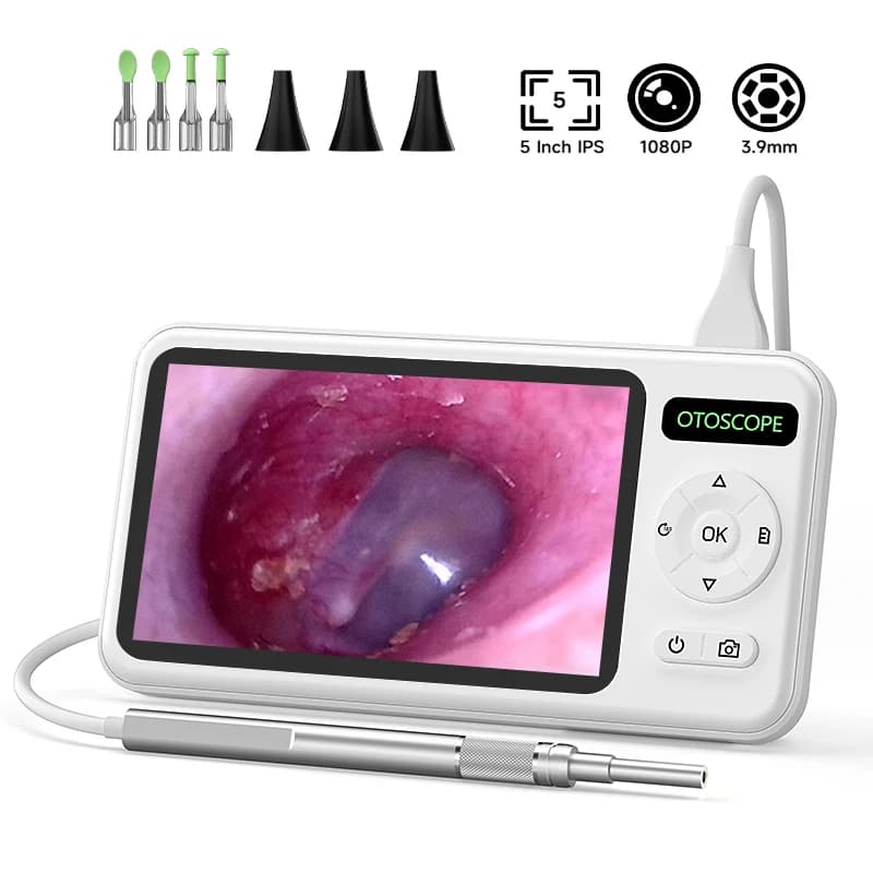 Fotocamera per otoscopio digitale con schermo da 5 pollici HD1080P 3.9MM Ear Picker 6 led strumento per la rimozione del cerume Stick per la pulizia dell'orecchio per bambini adulti