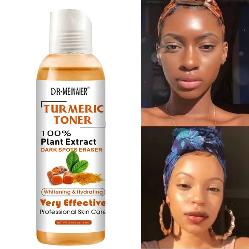 Curcuma tone Siero face brightening Dark corrector Whitening serum Vitamin C Ginger essence Korean cosmetics