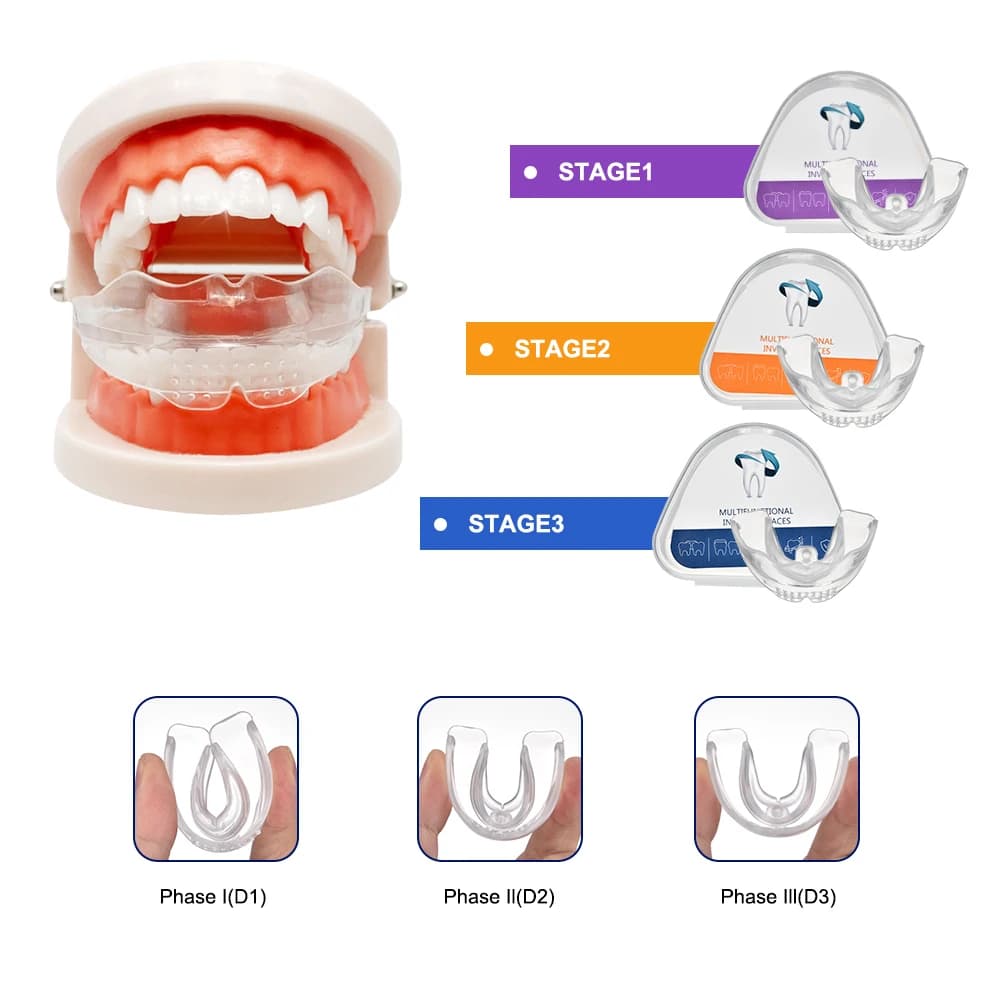 Dental accessories 3 phases Dental equipment Denti Trainer Alignment Bocchino Orthodontic tooth Brace Raddrizer for adults