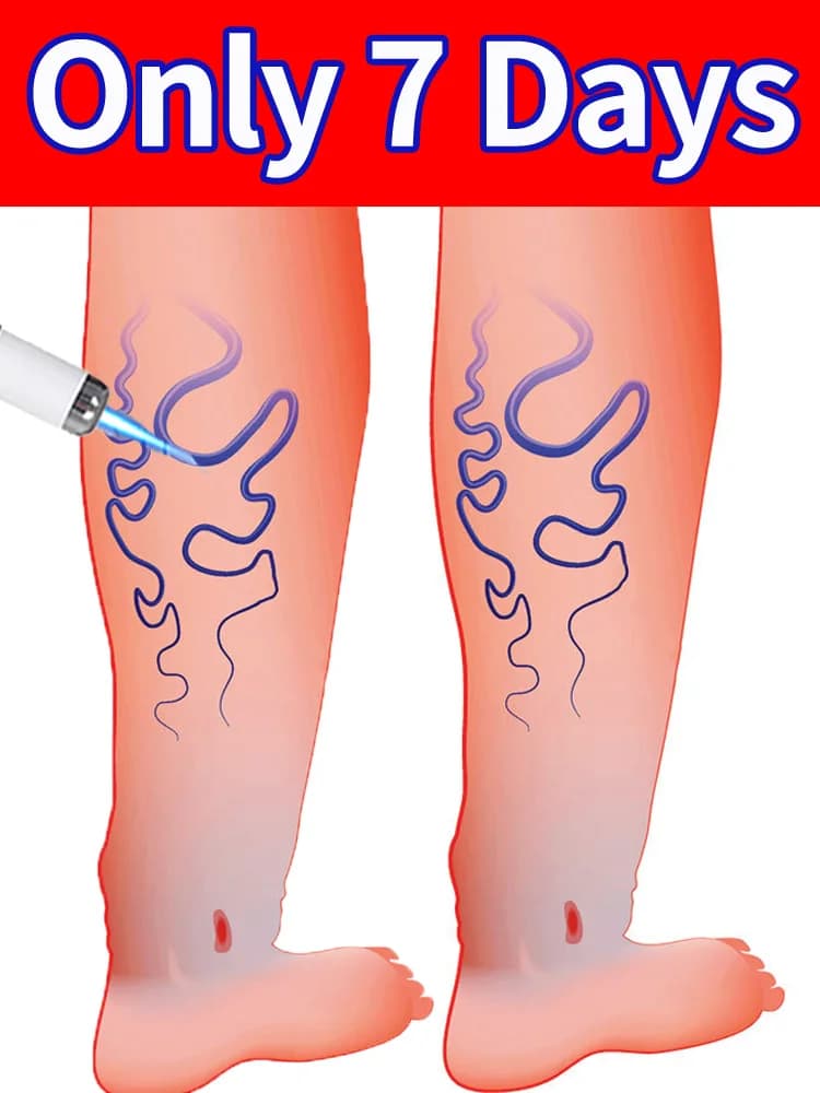 Ottieni gambe salutari in 7 giorni