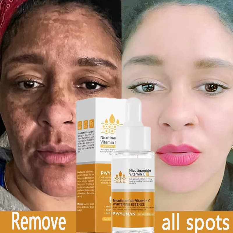 Powerful removal dark spots serum whitening lentil face melanin correction anti pigmentation illuminates skin products for beauty care