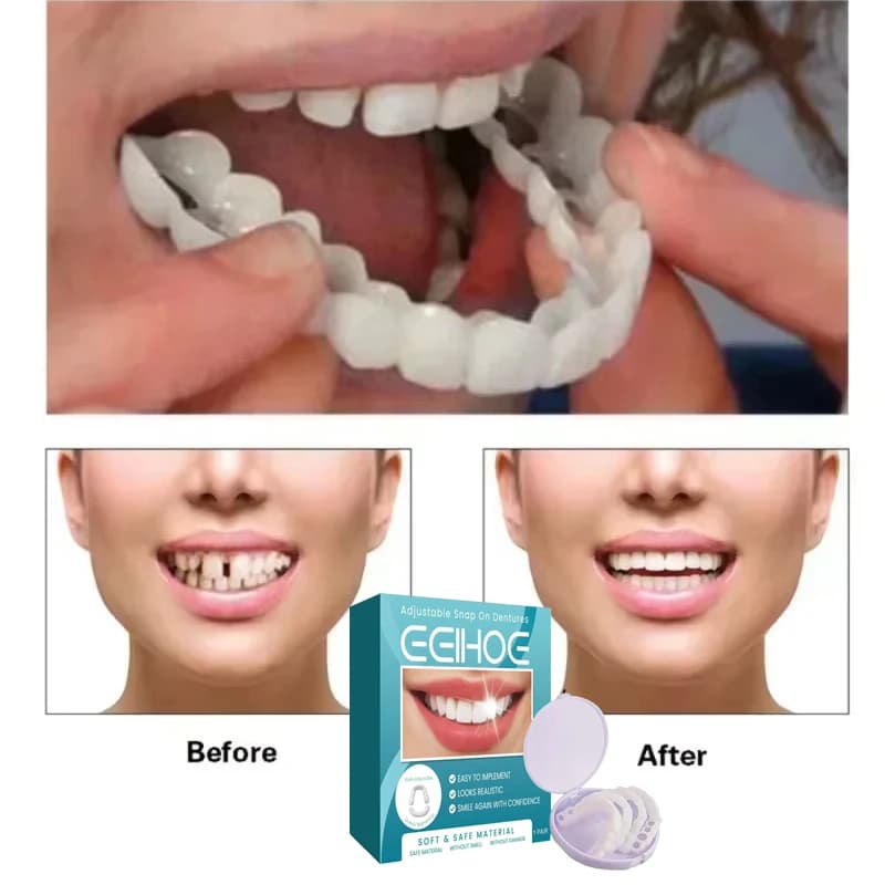 Set di denti regolabili Protesi sbiancanti Sorriso perfetto temporaneo Falso 2026 Impiallacciature dentali rimovibili superiori inferiori Set di denti finti
