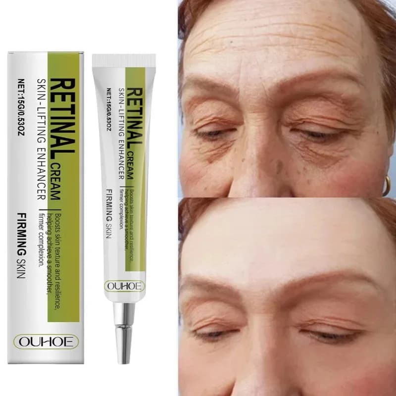Retinol Cream Tightening Anti Wrinkle Improve Sagging Moisturizing Smoothing Lightening Firming Radiant Fine Lines Removal Cream