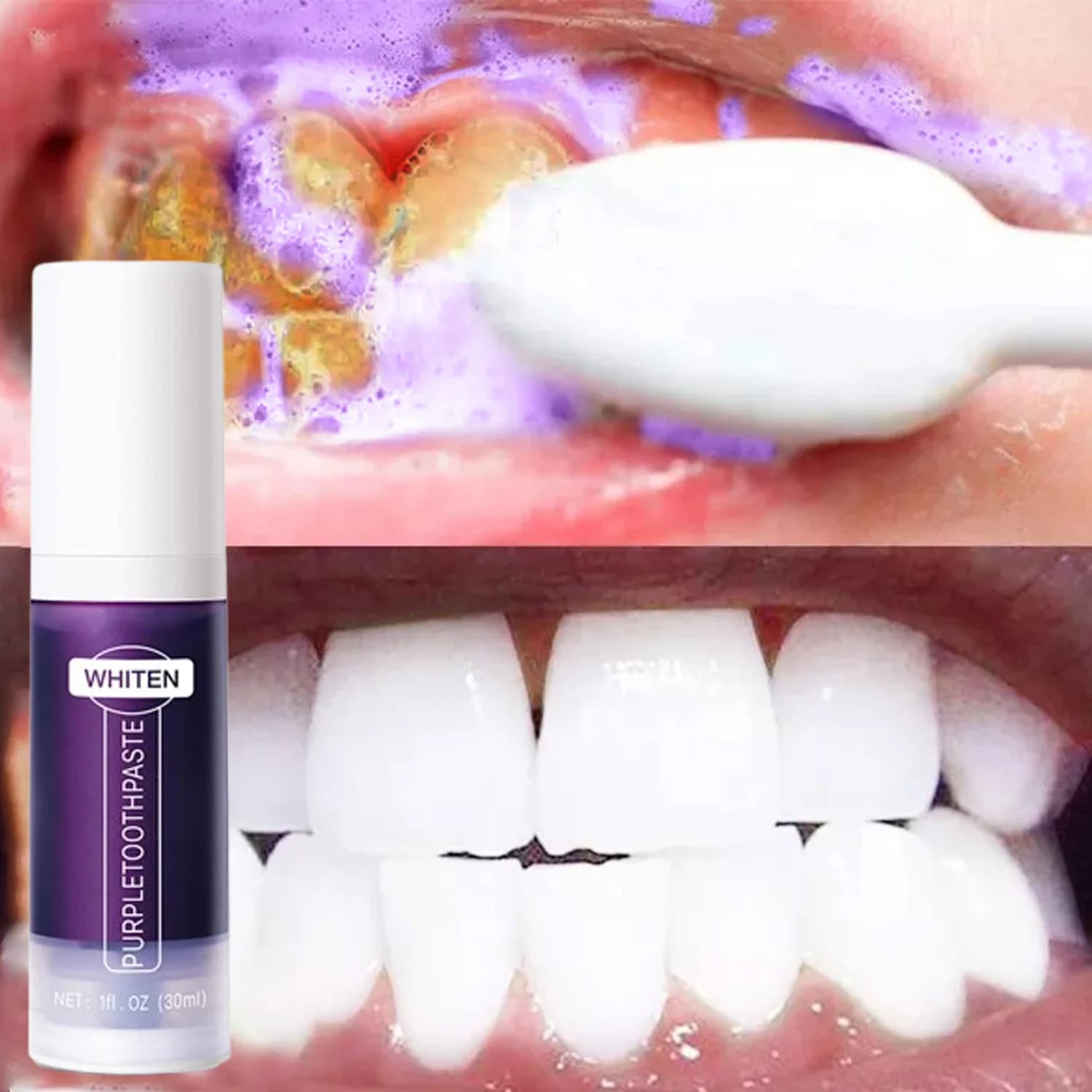 Dentifricio sbiancante per denti 5d Strisce sbiancanti per denti Pulizia dell'igiene orale Strumenti per sbiancamento dentale Alito fresco Cura della odontoiatria Nuovo
