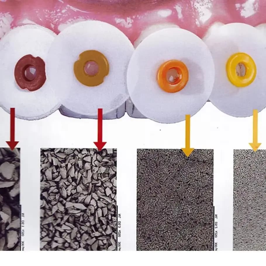 40/50Pcs Dental Finishing & Polishing Discs &1Mandrel Set or Refill P12 Coarse/Medium/Fine/ Superfine for Composite Restorations
