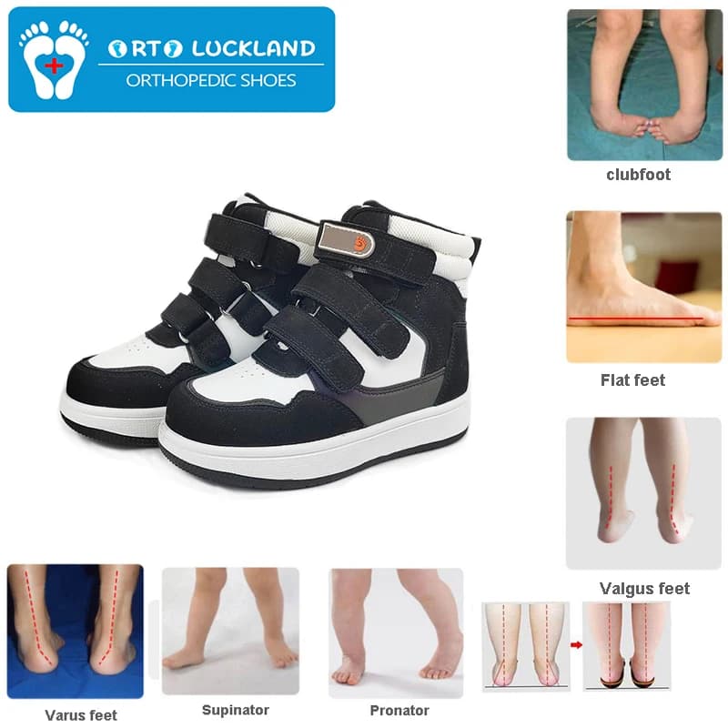 Scarpe da ginnastica per bambini, scarpe ortopediche per bambini, scarpe da ginnastica casual in pelle per bambine, scarpe da corsa con supporto per la caviglia