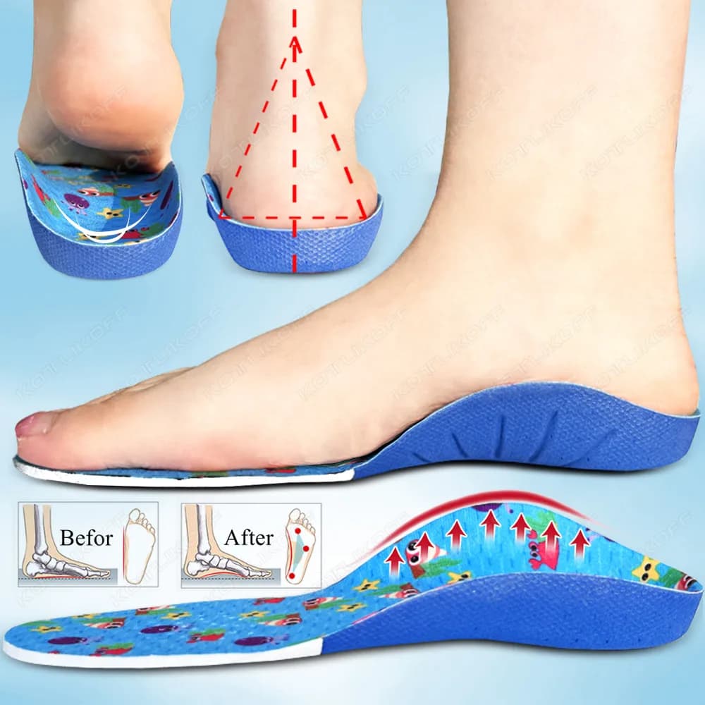 Solette ortopediche per bambini sottopiede piatto supporto per arco correzione prevenire l'eversione plantare, cuscinetti per Sneaker Comfort per gambe a forma di X/O