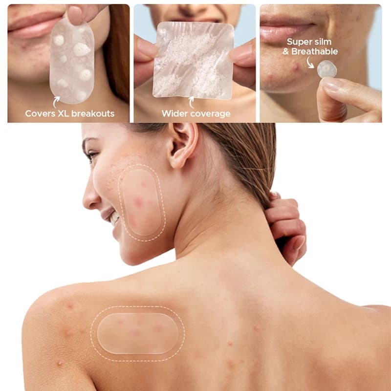 Nuovi 116 Cerotti Invisibili Anti-Acne - Patch Riparatori per Rimozione Brufoli e Segni, Strumento di Bellezza per la Cura delle Imperfezioni del Viso