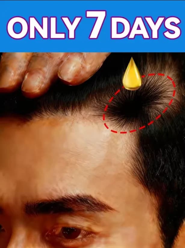 Quick hair growth oil with biotin, scalp care products, massage treatments, against hair loss, effective to grow thicker hair, serum for men