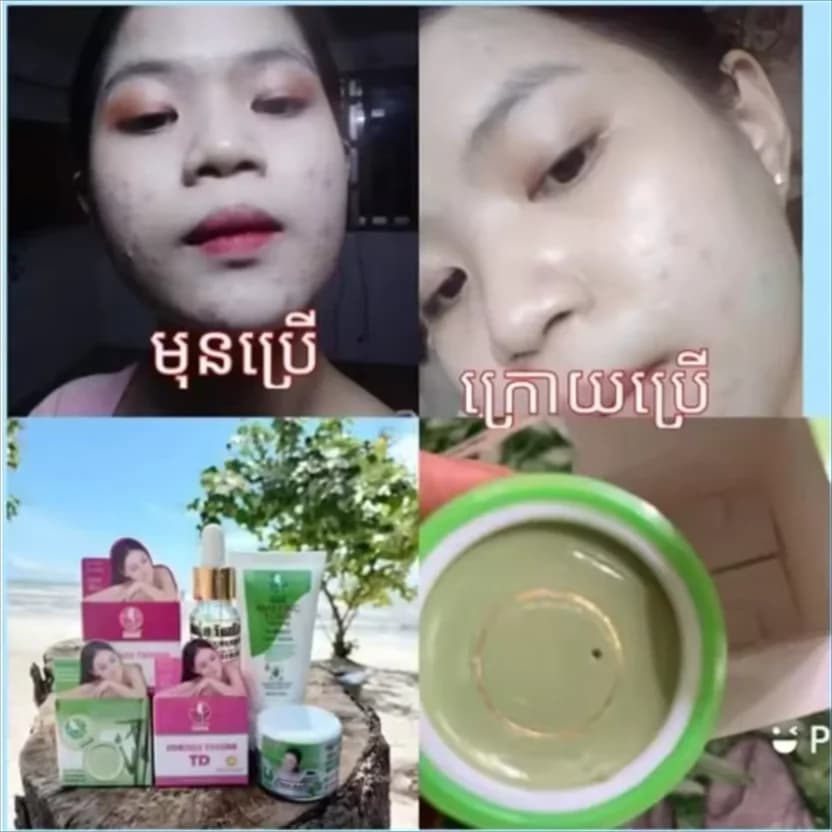 Crema notte thailandese sbiancante, schiarente e anti-acne