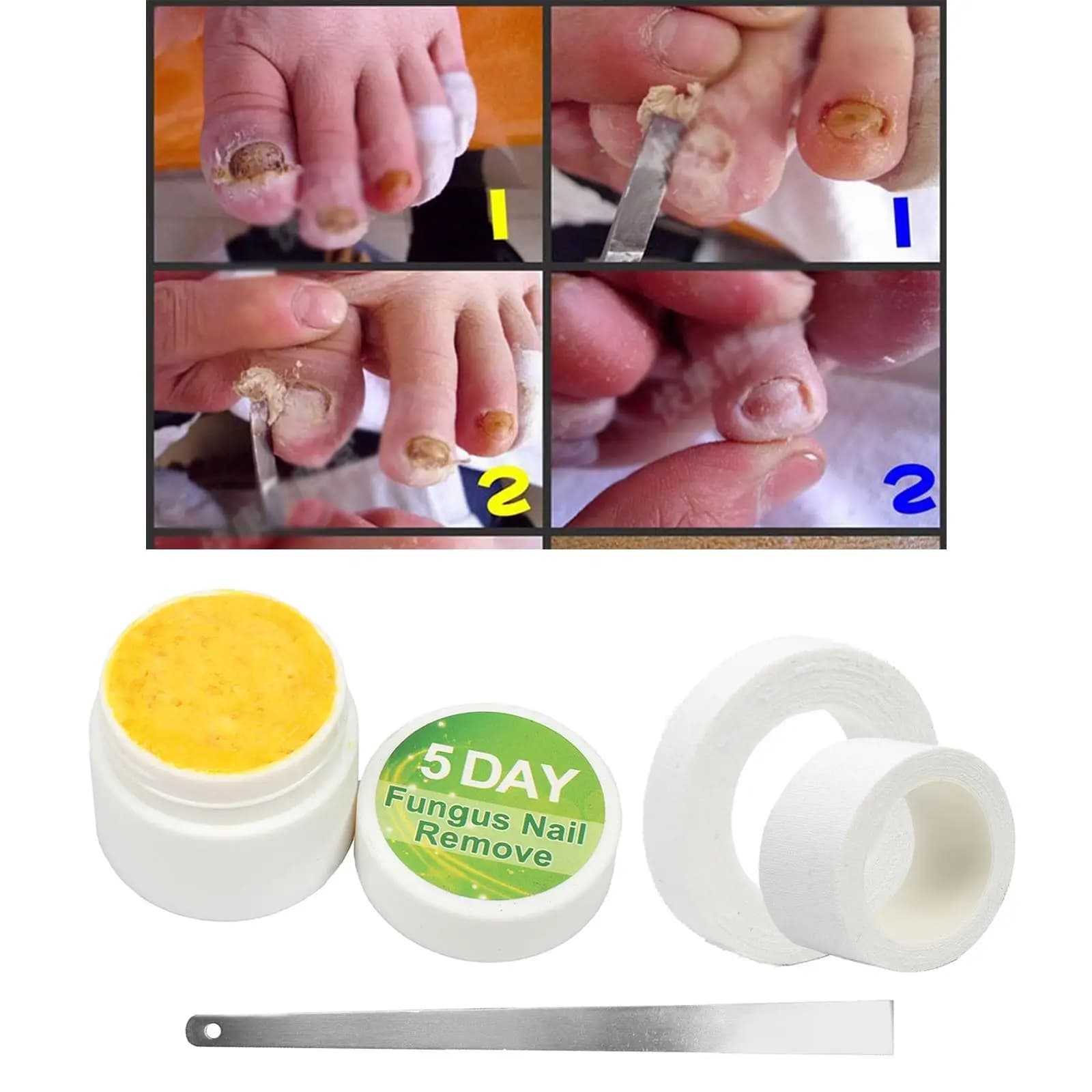 Fungal Nail Repair Essence Serum Care Treatment Foot Nail Fungus Removal Gel Anti Onychomycosis Foot Toenail Care