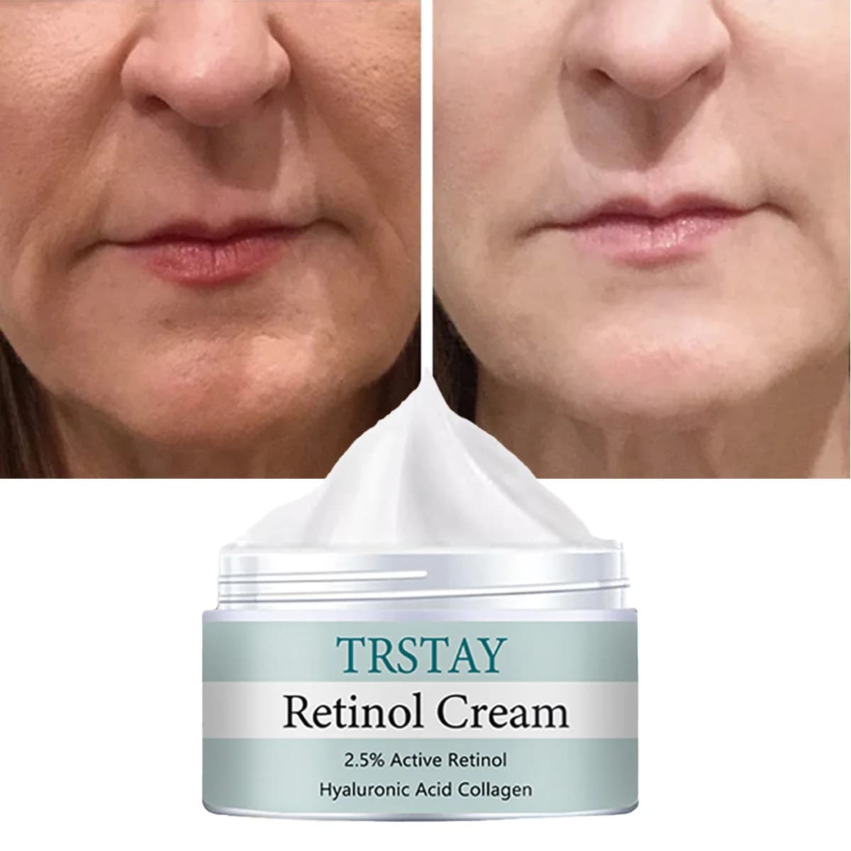 TRSTAY retinol cream 2.5% Active retinoid Hyaluronic acid Hydrating face anti-aging wrinkle reduction Whitening