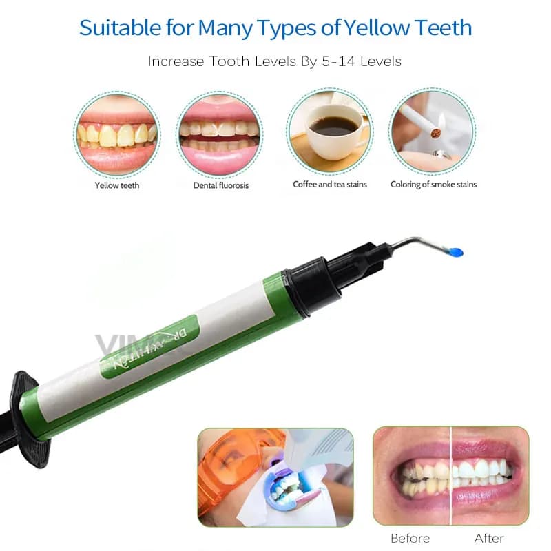 35% Dental Tooth Whitening Agent Gel Kit HP works with tooth whitening set accelerator for teeth whitening beauty teeth