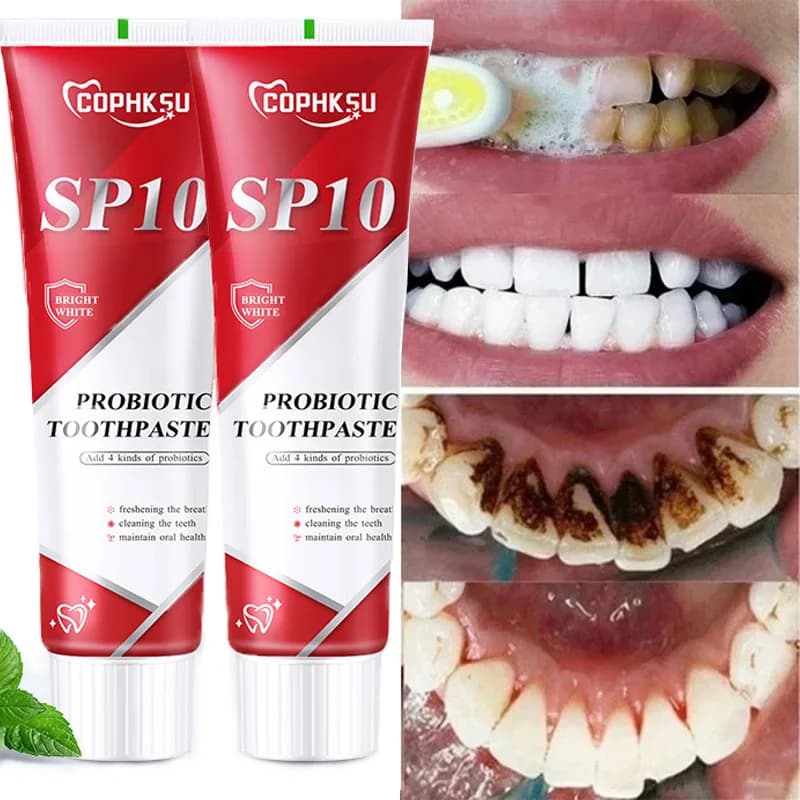 Probiotic toothpaste SP-10 Teeth whitening Remove plaque stains Teeth whitening Oral hygiene Clean fresh breath Denta 100g New