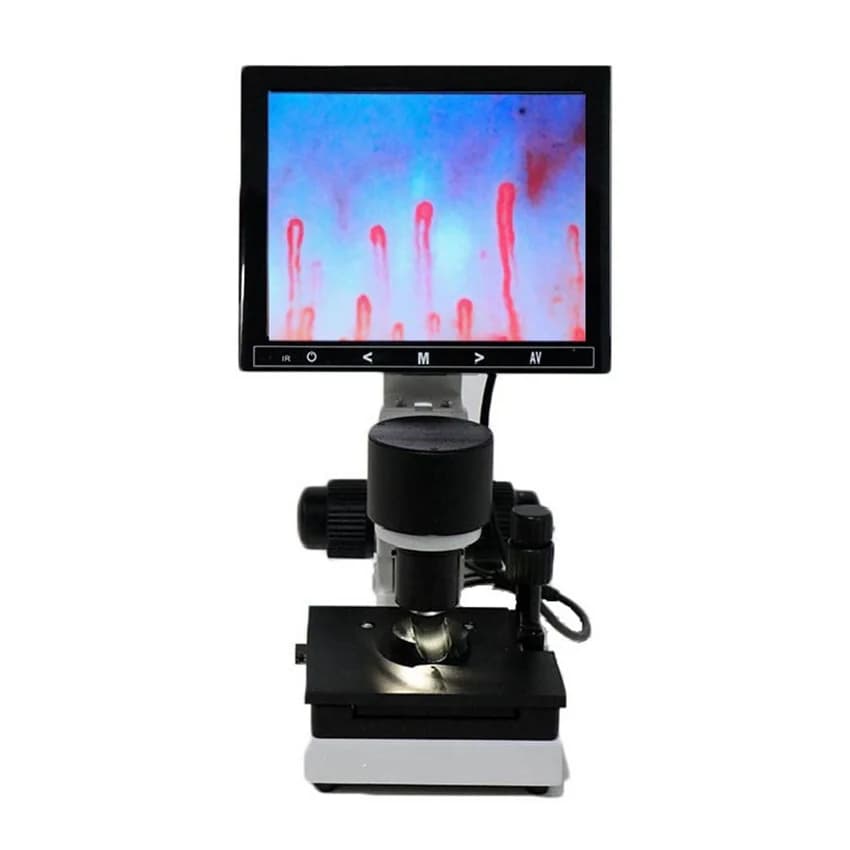 Digital Microscope Zoom Nailfold Rilevatore di Microcircolazione Capillare Microcircolazione del Sangue Analyzer con 7/8/9 "Schermo Digitale