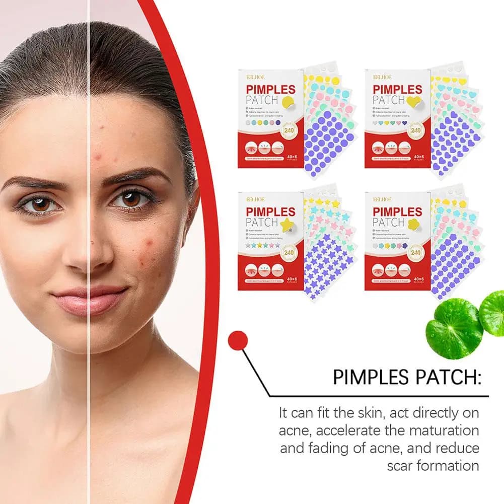 240 pezzi nuove cerotti per brufoli cerotti per acne cuore/stella/fiore/forma rotonda cerotti per punti per acne idrata per coprire le brufoli e le imperfezioni