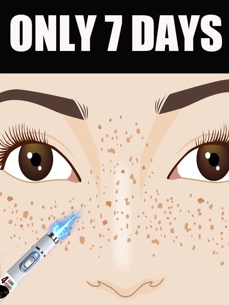 Face care tools, blue light pen can solve a variety of problems, free shipping.