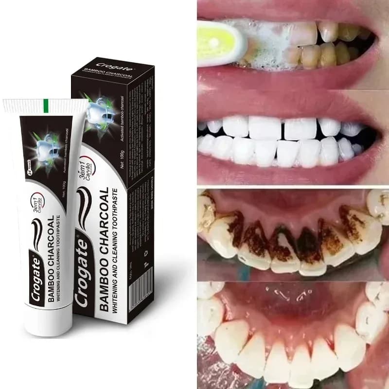 Bamboo Carbon White toothpaste, Absorbs Bad breath, Remove Yellow Tooth Whitening, Deep Macchie Cleansing on Tooths, Oral Care