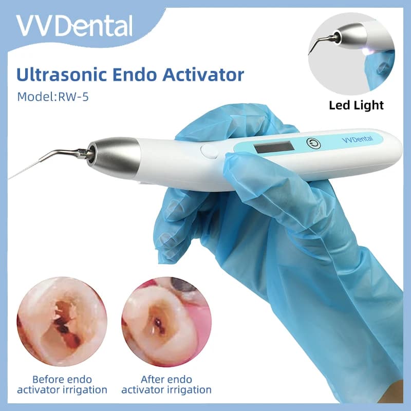Attivatore endo ad ultrasuoni VVDental con irrigatore sonico del canale radicolare a LED per la rimozione della pulizia endodonzia Endomotor per macchie calcificate