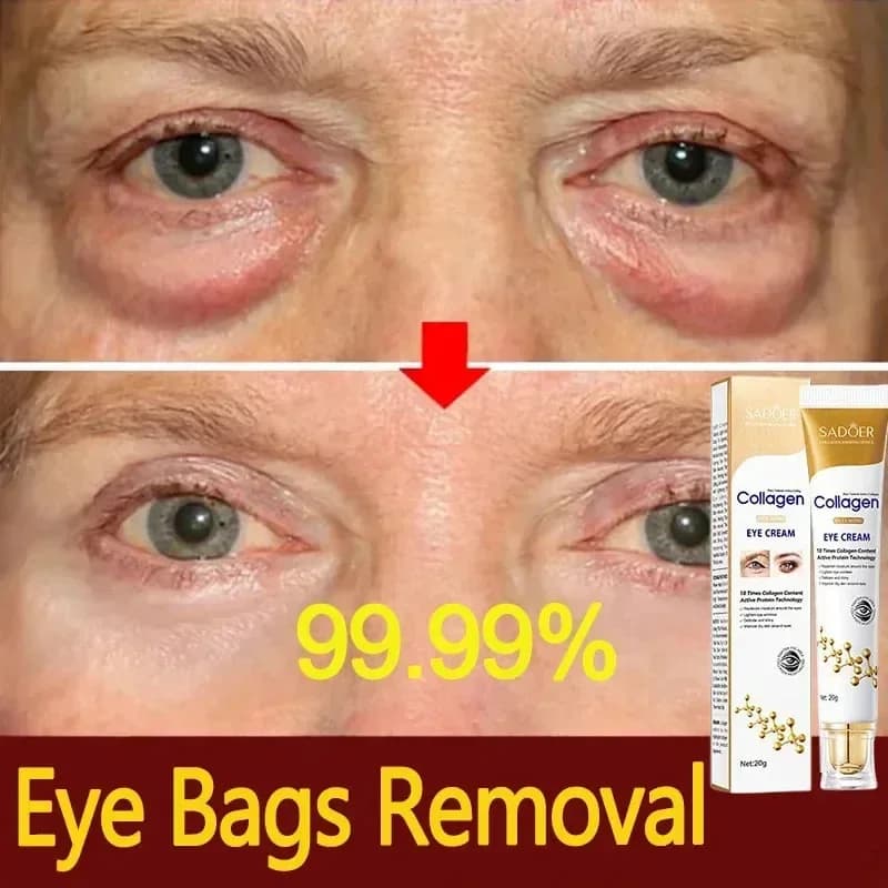 SADOER Cream for Instant Removal of Handbags for Eye Collagen Anti-wrinkles Dissolvency Thin Lines Skin Thickening Anti Dark Circle Gonfiore Illuminate Eyes
