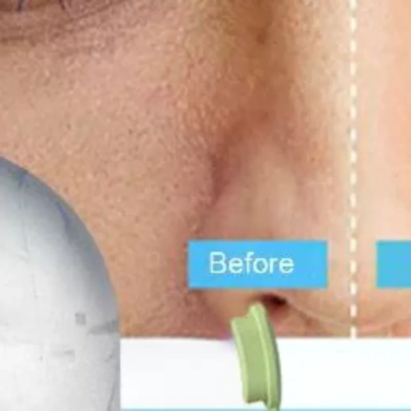 Stampo in silicone per massaggio viso con rullo di ghiaccio, per gonfiore occhi, rullo facciale refrigerante, riduzione dei pori, stampo multifunzionale