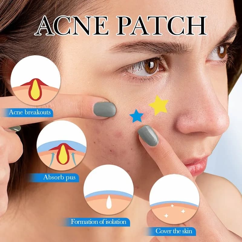 75 cerotti/scatola di cerotti per l'acne a forma di stella multicolore, cerotti per l'acne del viso, cerotti coprenti per l'acne e cerotti per brufoli, ultrasottili